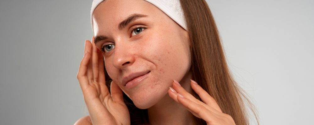 Cera trądzikowa a woda siarczkowa - naturalne wsparcie w pielęgnacji problematycznej skóry