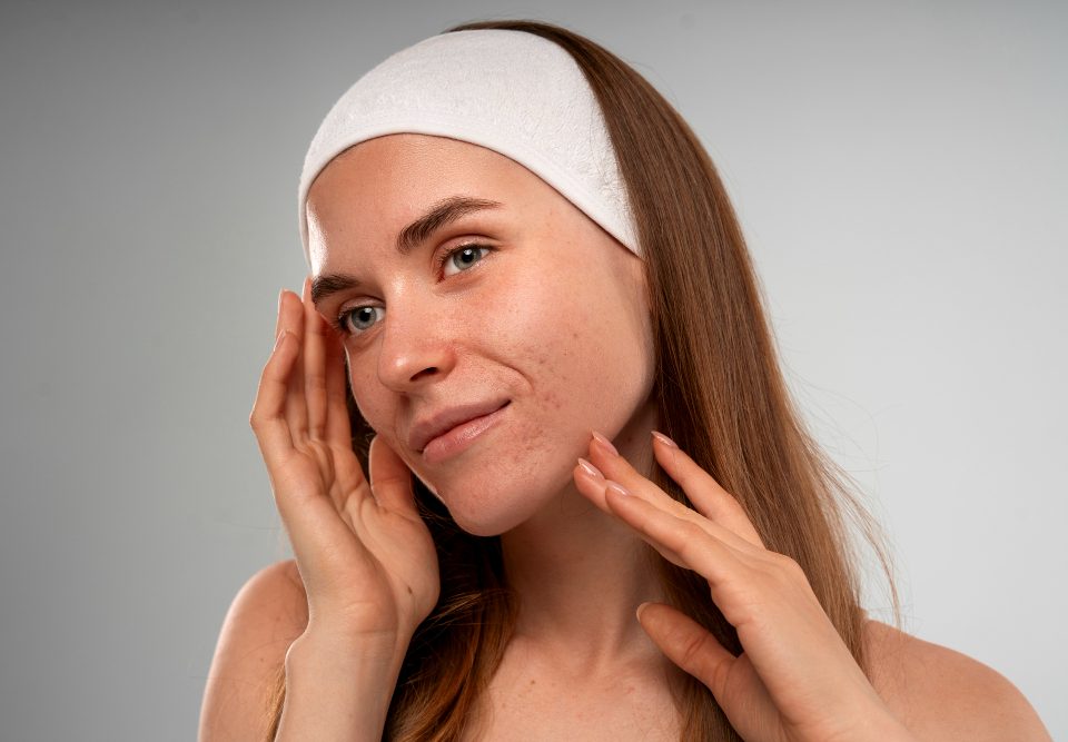 Cera trądzikowa a woda siarczkowa - naturalne wsparcie w pielęgnacji problematycznej skóry